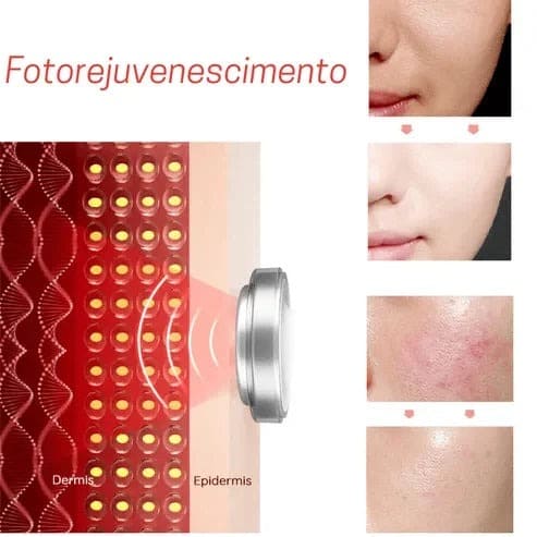 Aparelho rejuvenescedor: anti rugas e anti sinais