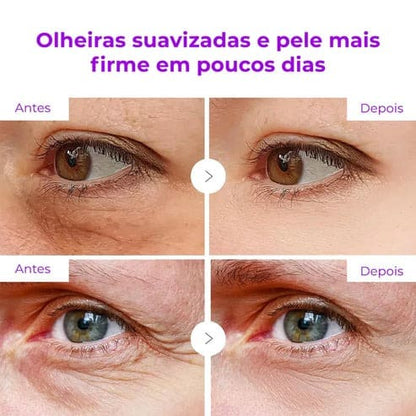 DermaLift – Bastão Firmador de Cálcio